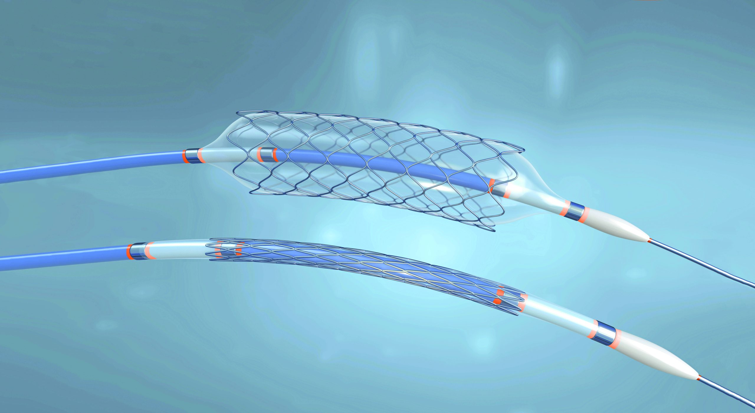 Catheter Assembly